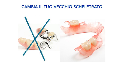 Piastre odontotecnici in plexiglass trasparente basette metacrilato.